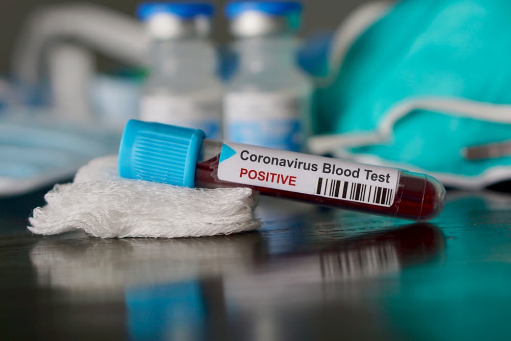 Positive Coronavirus blood test is on a table.