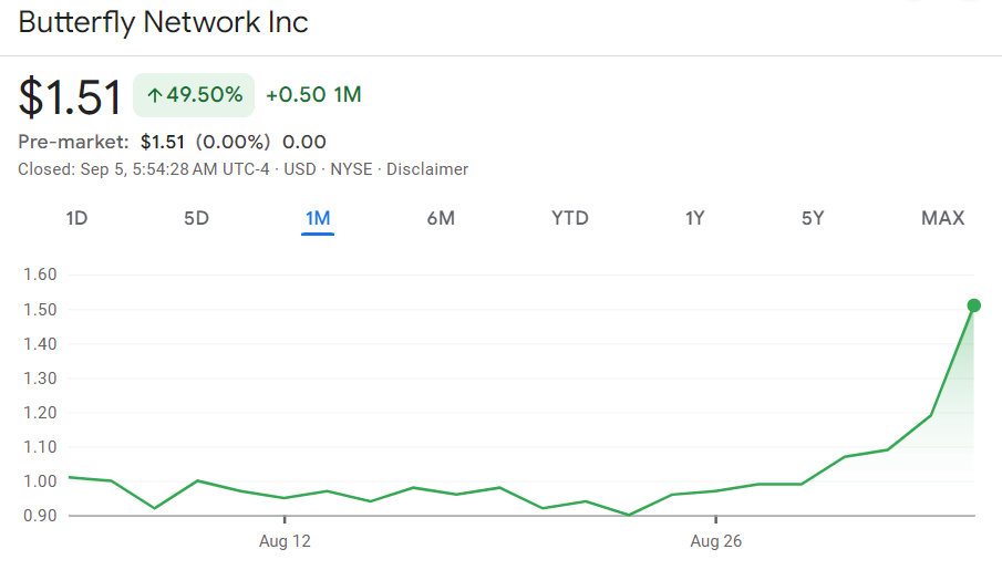 Butterfly Network stock price 1-month chart. Source: Google Finance